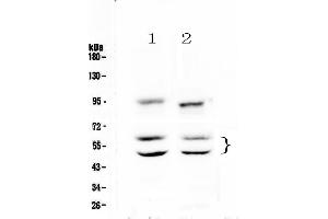 Western blot analysis of CaMKII alpha using anti-CaMKII alpha antibody . (CAMK2A antibody  (AA 392-457))