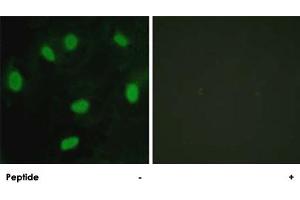 Immunofluorescence analysis of HeLa cells, using TBX15/TBX18 polyclonal antibody . (T-Box 15 antibody)