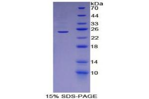 SDS-PAGE (SDS) image for Perilipin 2 (PLIN2) (AA 245-433) protein (His tag) (ABIN2120471) (ADRP Protein (AA 245-433) (His tag))