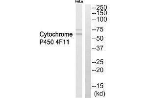 Western blot analysis of extracts from HeLa cells, using Cytochrome P450 4F11 antibody. (CYP4F11 antibody  (Internal Region))