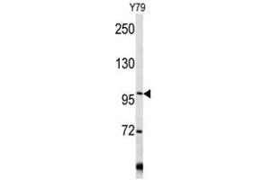 Image no. 1 for anti-Collagen, Type VI (COL6) (C-Term), (Chain alpha 1) antibody (ABIN452856)