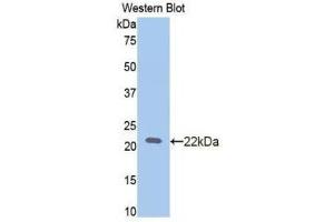 Western Blotting (WB) image for anti-Slit Homolog 2 (Drosophila) (SLIT2) (AA 209-374) antibody (ABIN1173404) (SLIT2 antibody  (AA 209-374))