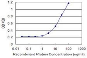 Detection limit for recombinant GST tagged ALDH1A1 is 1 ng/ml as a capture antibody. (ALDH1A1 antibody  (AA 1-501))