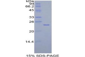SDS-PAGE analysis of Rat TIMP4 Protein. (TIMP4 Protein)