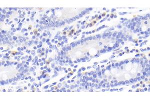 Detection of CTLA4 in Human Small intestine Tissue using Monoclonal Antibody to Cytotoxic T-Lymphocyte Associated Antigen 4 (CTLA4) (CTLA4 antibody  (AA 52-211))