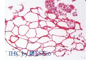 ABIN2613464 (2. (PLIN4 antibody  (Internal Region))