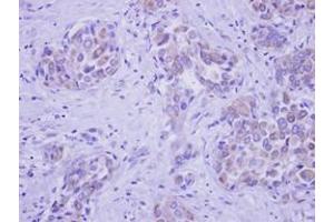 Image no. 1 for anti-UDP-N-Acetyl-alpha-D-Galactosamine:polypeptide N-Acetylgalactosaminyltransferase 2 (GalNAc-T2) (GALNT2) (AA 272-523) antibody (ABIN1498370) (GALNT2 antibody  (AA 272-523))