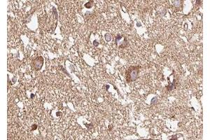 ABIN6267615 at 1/100 staining human brain tissue sections by IHC-P. (GRIN1/NMDAR1 antibody  (pSer890))