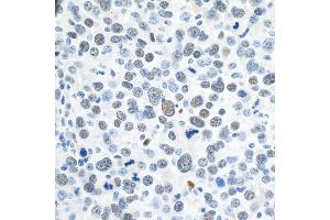 Immunohistochemistry (IHC) image for anti-Zinc Finger E-Box Binding Homeobox 1 (ZEB1) (AA 1074-1124) antibody (ABIN7454797)