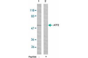 Western blot analysis of extracts from HeLa cells using ATF2 polyclonal antibody . (ATF2 antibody)