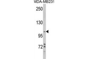 Western Blotting (WB) image for anti-Phosphoinositide-3-Kinase, Class 3 (PIK3C3) antibody (ABIN3000299) (PIK3C3 antibody)