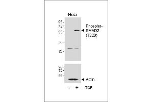 Western blot analysis of lysates from Hela cell line, untreated or treated with TGF-β, 100 ng/mL, 30 min, using Phospho-SD2 Antibody (ABIN650816 and ABIN2839794) (upper) or Beta-actin (lower). (SMAD2 antibody  (pThr220))