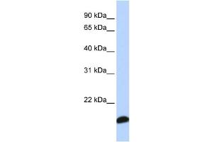 WB Suggested Anti-PRDX5 Antibody Titration: 0. (Peroxiredoxin 5 antibody  (Middle Region))