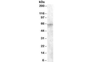 Western blot testing of HepG2 cell lysate with IGF2BP2 antibody at 1ug/ml. (IGF2BP2 antibody)