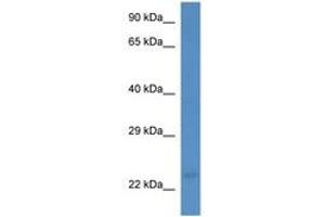 Image no. 1 for anti-Membrane-Associated Ring Finger (C3HC4) 3, E3 Ubiquitin Protein Ligase (MARCH3) (AA 128-177) antibody (ABIN6746215) (MARCH3 antibody  (AA 128-177))