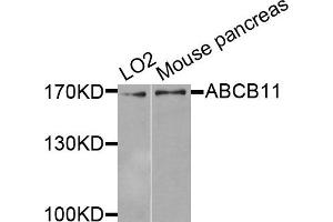 Western blot analysis of extracts of various cells, using ABCB11 antibody. (ABCB11 antibody)
