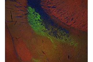 Indirect immunostaining of PFA fixed mouse brain section with anti-SV 2C (dilution 1 : 200; green) and rabbit anti-endophilin (ABIN1742336, dilution 1 : 200; red). (SV2C antibody  (AA 2-16))