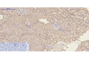 Immunohistochemistry of paraffin-embedded Rat kidney tissue using CD23 Monoclonal Antibody at dilution of 1:200. (FCER2 antibody)