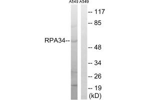 Western blot analysis of extracts from A549 cells, using CD3EAP antibody.