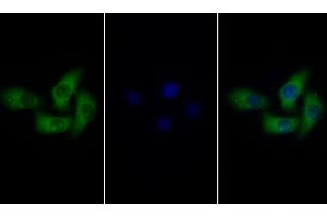 Detection of gp130 in Human Hela cell using Polyclonal Antibody to Glycoprotein 130 (gp130) (CD130/gp130 antibody  (AA 238-500))