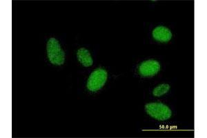 Immunofluorescence of purified MaxPab antibody to RNF36 on HeLa cell. (TRIM69 antibody  (AA 1-341))