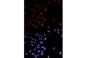 Immunofluorescence analysis of U2OS cells using Phospho-MYC-S62 antibody (ABIN5969927). (c-MYC antibody  (pSer62))