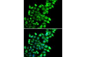 Immunofluorescence analysis of U2OS cells using MEST antibody (ABIN6133292, ABIN6143749, ABIN6143751 and ABIN6222673). (MEST antibody  (AA 146-335))