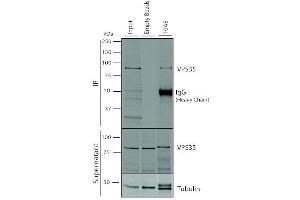Immunoprecipitation (IP) image for anti-Vacuolar Protein Sorting 35 (VPS35) antibody (PerCP) (ABIN6933001)