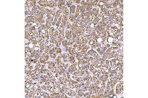 IHC analysis of STAP2 using anti-STAP2 antibody (ABIN7602686). (STAP2 antibody  (AA 95-392))
