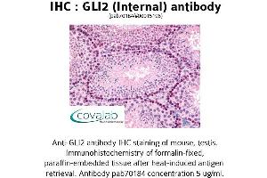 Image no. 1 for anti-GLI Family Zinc Finger 2 (GLI2) (Internal Region) antibody (ABIN1734718) (GLI2 antibody  (Internal Region))