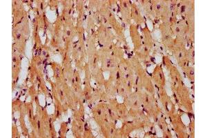 IHC image of ABIN7167509 diluted at 1:400 and staining in paraffin-embedded human heart tissue performed on a Leica BondTM system. (PTPRK antibody  (AA 589-749))