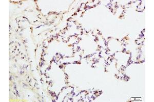 Formalin-fixed and rat lung tissue labeled with Anti-IQGAP1 Polyclonal Antibody, Unconjugated  at 1:200 followed by conjugation to the secondary antibody and DAB staining