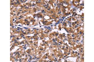 Immunohistochemistry (IHC) image for anti-Selectin P Ligand (SELPLG) antibody (ABIN2422074) (SELPLG antibody)