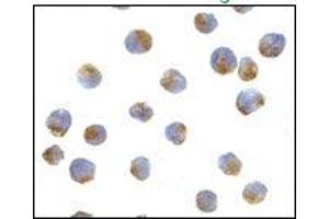 AP20056PU-N ATG7 antibody staining of L1210 cells by Immunocytochemistry at 10 μg/ml. (ATG7 antibody  (N-Term))