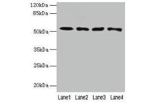 Western blot All lanes: CAP2 antibody at 4 μg/mL Lane 1: HepG2 whole cell lysate Lane 2: Mouse muscle tissue Lane 3: Mouse gonadal tissue Lane 4: Hela whole cell lysate Secondary Goat polyclonal to rabbit IgG at 1/10000 dilution Predicted band size: 53, 46, 25 kDa Observed band size: 53 kDa