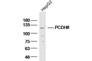 Lane 1: HepG2 lysates probed with Anti PCDH8 Polyclonal Antibody, Unconjugated (bs-11114R) at 1:300 overnight at 4˚C. (Protocadherin 8 antibody  (AA 51-150))