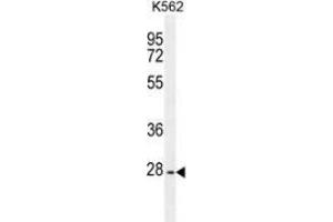 Western blot analysis in K562 cell line lysates (35ug/lane) using PTPN20  Antibody . (PTPN20 antibody  (Middle Region))