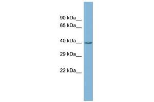 WB Suggested Anti-ZCCHC12 Antibody Titration: 0. (ZCCHC12 antibody  (Middle Region))