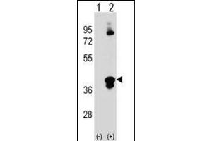 Western blot analysis of C1QTNF1 (arrow) using rabbit polyclonal C1QTNF1 Antibody (N-term) (ABIN390541 and ABIN2840881). (C1QTNF1 antibody  (N-Term))