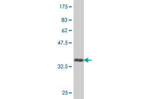 Western Blot detection against Immunogen (38. (NOS1 antibody  (AA 1041-1150))