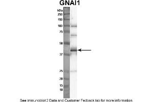 Sample Type: Nthy-ori cell lysate (50ug)Primary Dilution: 1:1000Secondary Antibody: anti-rabbit HRPSecondary Dilution: 1:2000Image Submitted By: Anonymous (GNAI1 antibody  (Middle Region))