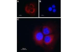 Expression of TRIC-B in mouse muscle myoblast (C2C12) cell line - Immunocytochemical staining of mouse paraformaldehyde-fixed and permeabilized muscle myoblast (C2C12) cell line. (TMEM38B antibody  (Cytoplasmic Loop, Intracellular))