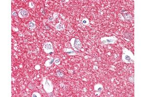 Anti-Amphiphysin antibody IHC of human brain, cortex. (Amphiphysin antibody  (AA 1-347))