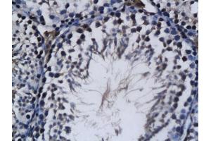 Formalin-fixed and paraffin embedded mouse testis labeled with Anti RNF43 Polyclonal Antibody, Unconjugated (ABIN721600) followed by conjugation to the secondary antibody and DAB staining (RNF43 antibody  (AA 41-140))