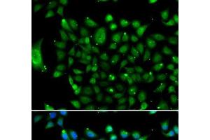 Immunofluorescence analysis of U2OS cells using NCOR1 Polyclonal Antibody (NCOR1 antibody)