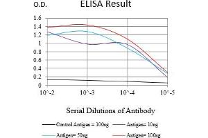 Black line: Control Antigen (100 ng),Purple line: Antigen (10 ng), Blue line: Antigen (50 ng), Red line:Antigen (100 ng) (Cytokeratin 13 antibody  (AA 104-458))