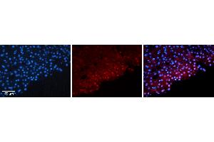 Rabbit Anti-FOSB Antibody   Formalin Fixed Paraffin Embedded Tissue: Human Liver Tissue Observed Staining: Nucleus in hepatocytes Primary Antibody Concentration: 1:100 Other Working Concentrations: N/A Secondary Antibody: Donkey anti-Rabbit-Cy3 Secondary Antibody Concentration: 1:200 Magnification: 20X Exposure Time: 0. (FOSB antibody  (N-Term))