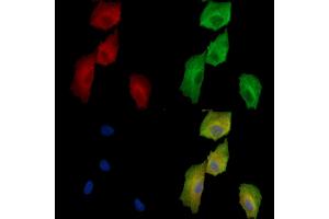 ABIN7096946 and ABIN7101012 staining  cells by IF/ICC.