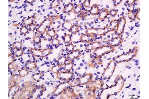 Immunohistochemistry (Paraffin-embedded Sections) (IHC (p)) image for anti-Granzyme A (Granzyme 1, Cytotoxic T-Lymphocyte-Associated serine Esterase 3) (GZMA) (AA 101-200) antibody (ABIN742335)