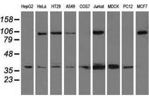 Western blot analysis of extracts (35 µg) from 9 different cell lines by using anti-XRCC1 monoclonal antibody. (XRCC1 antibody)